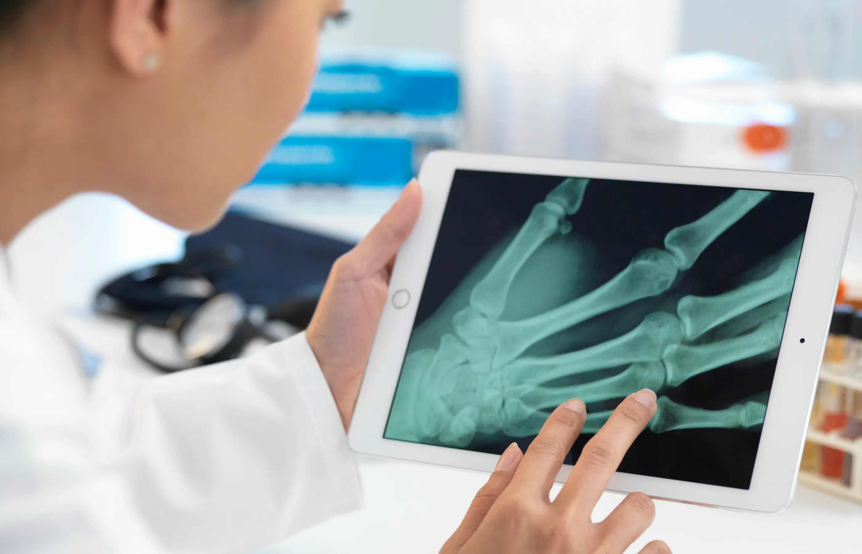 A health care provider is reviewing a x-ray of a patients hand on a tablet. 