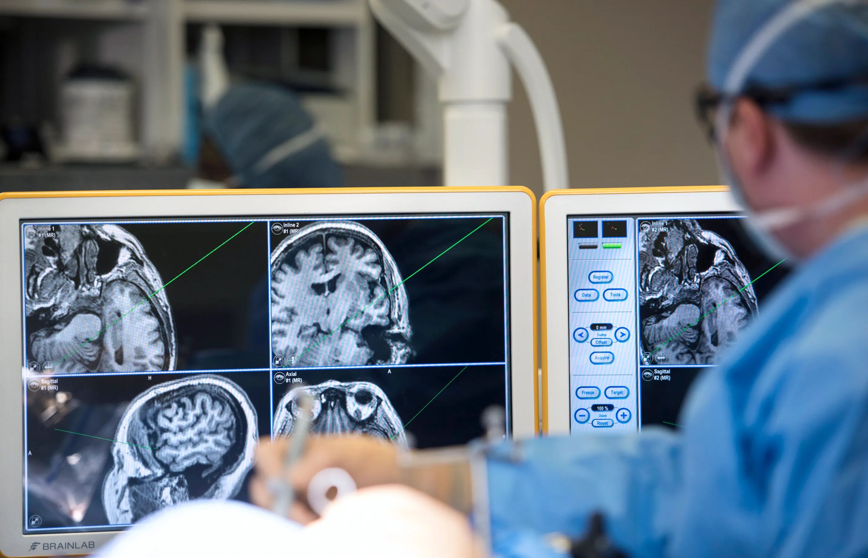 A Novant Health doctor is performing incisionless brain surgery. The surgeon is viewing the monitors that display images of the patients skull and brain. 