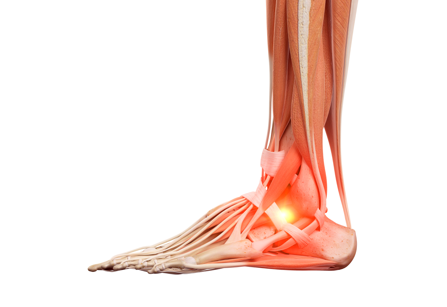 Close-up of a human ankle with visible muscles and ligaments, highlighting an area of pain.