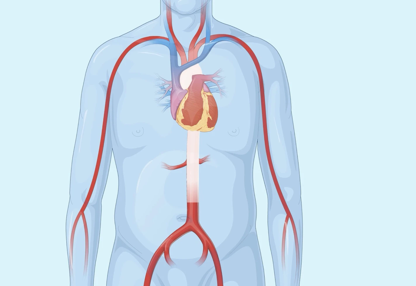 Medical illustration highlighting the aorta and major blood vessels throughout the body.