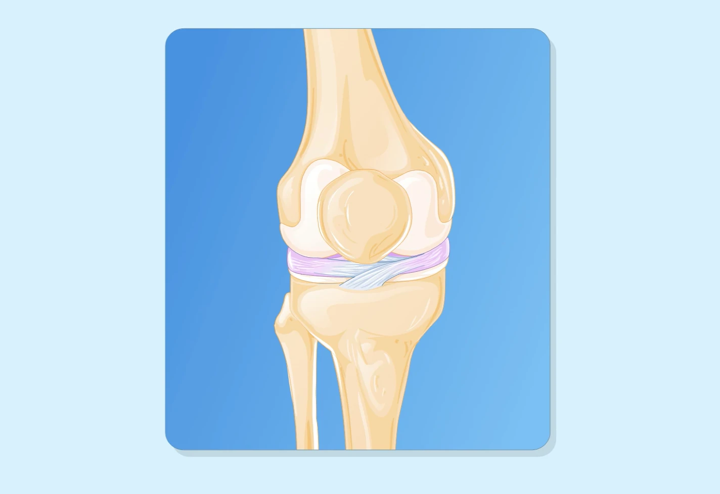 Medical illustration of knee joint anatomy used to explain a knee arthroscopy procedure. 