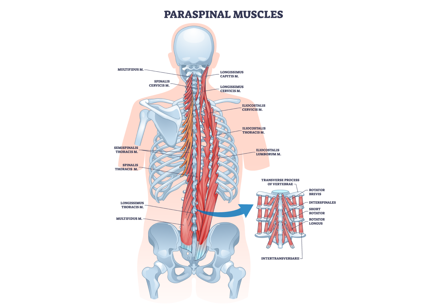 Diagram of paraspinal muscles with labeled groups including multifidus and longissimus.