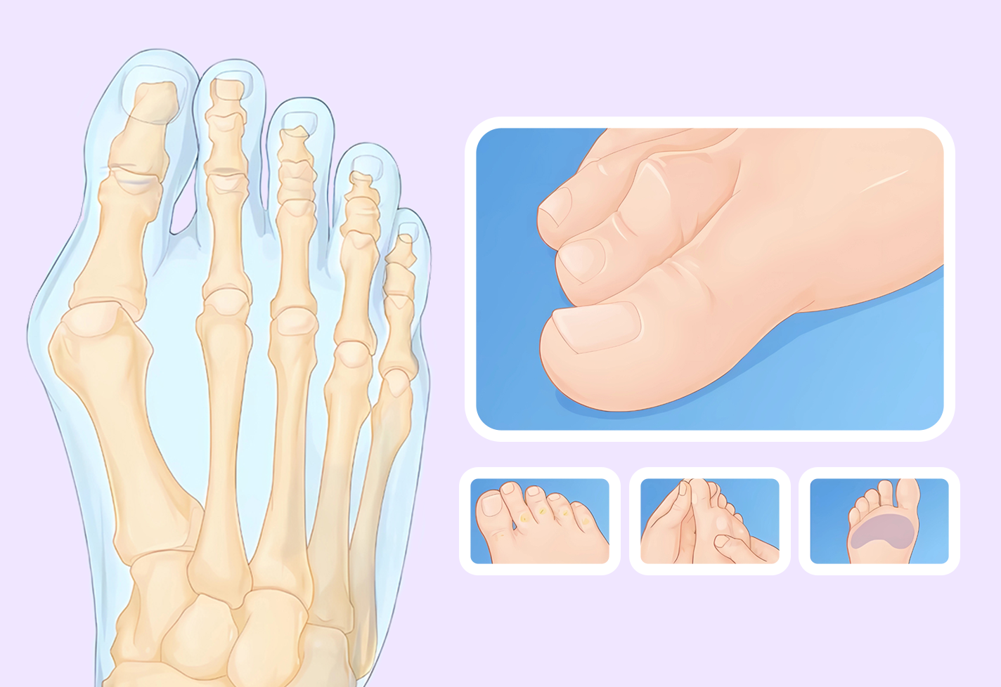 A skeletal diagram of a foot with detailed bones and various views of a foot, including toes, soles, and arches.