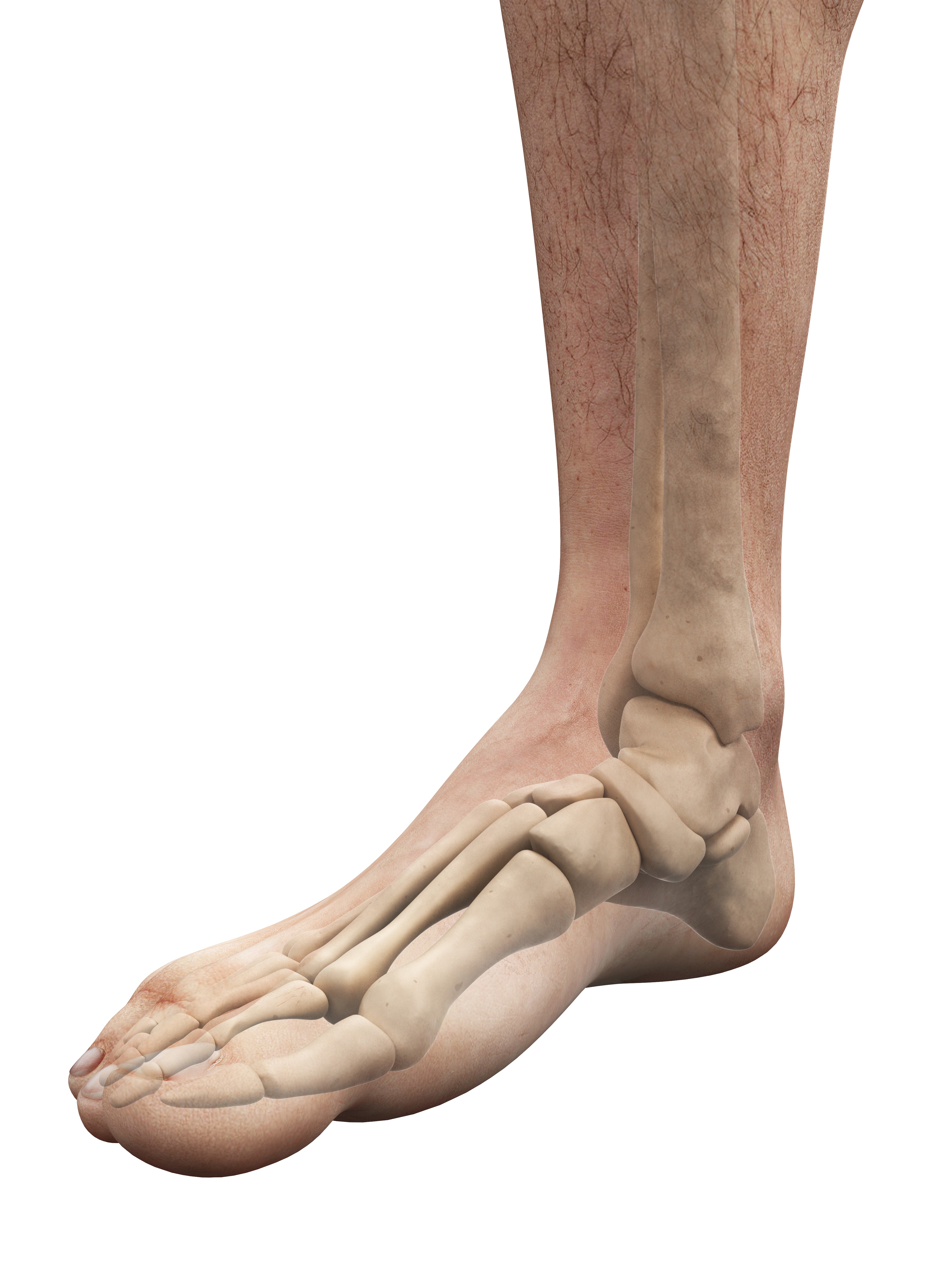 Medical illustration of foot and ankle bone anatomy showing the skeletal structures of the lower leg and foot.