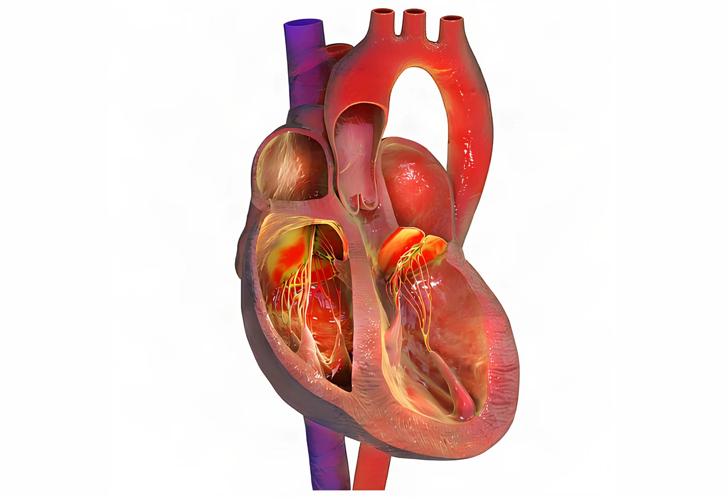 Medical diagram showing the heart's chambers, valves, and major blood vessels.    
