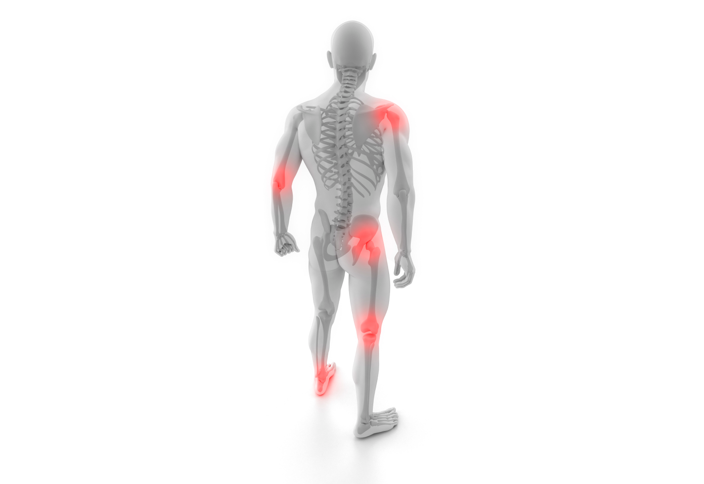 A 3D model of a human body showing joints highlighted, indicating pain areas.