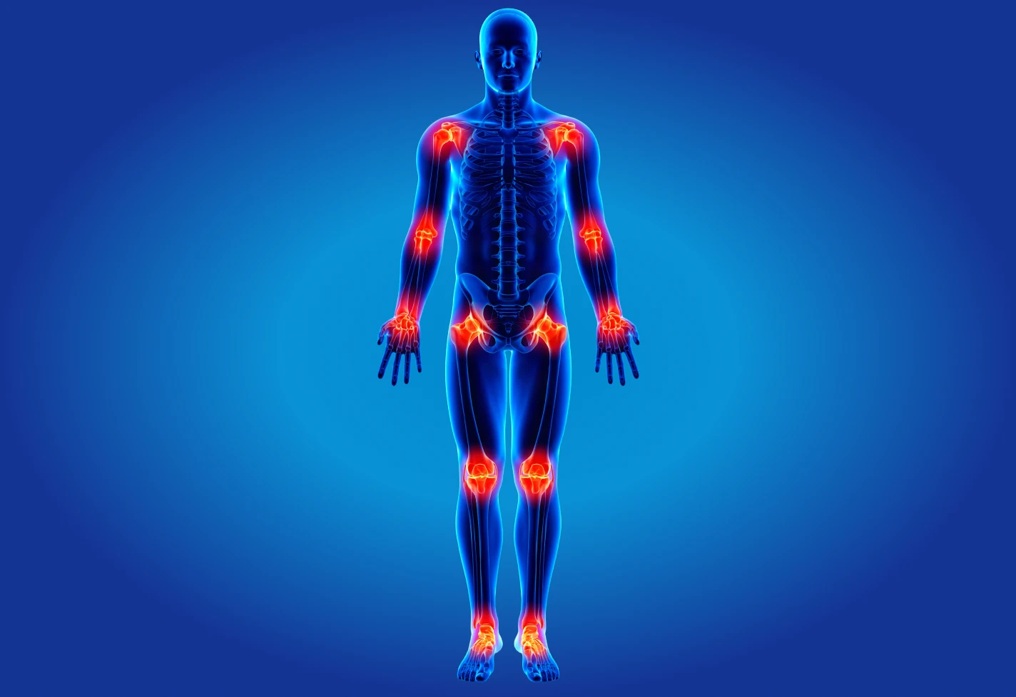 Medical illustration highlighting pain and inflammation in multiple joints throughout the body. 