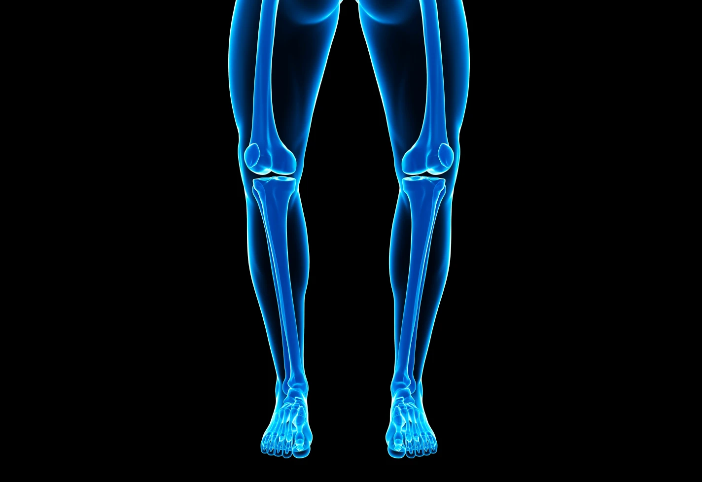 Front-view medical illustration of bowlegs. 