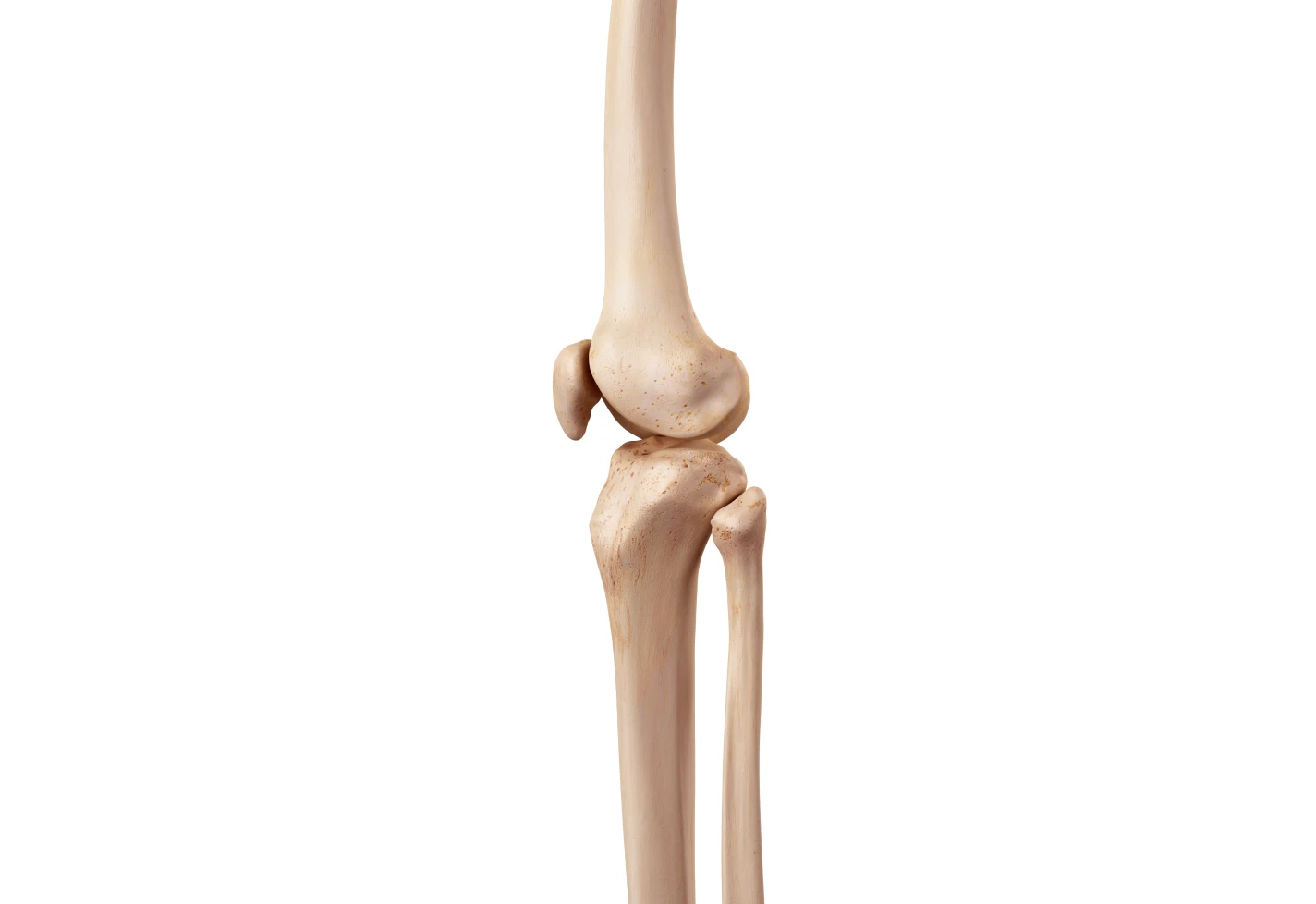 Medical illustration of knee skeletal anatomy showing femur, tibia, fibula and patella.