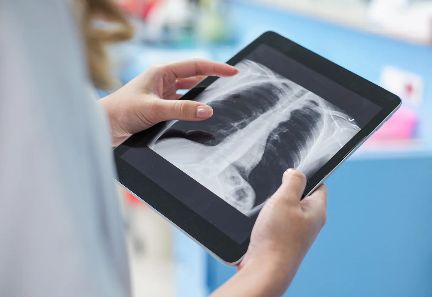 A health care provider is reviewing a patients chest x-ray on a tablet. 
