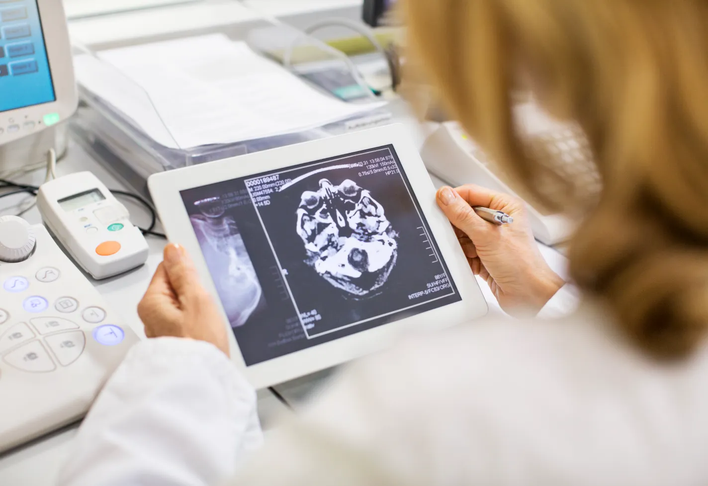 A health care provider is reviewing a brain scan on a tablet. 
