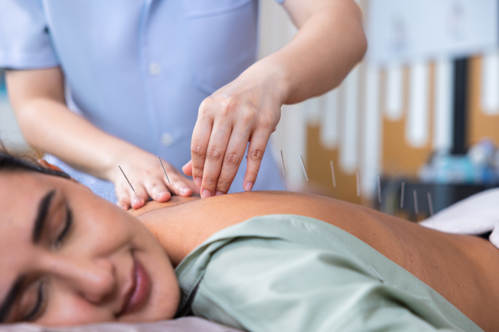 A woman relaxes on a treatment table while receiving acupuncture on her back.