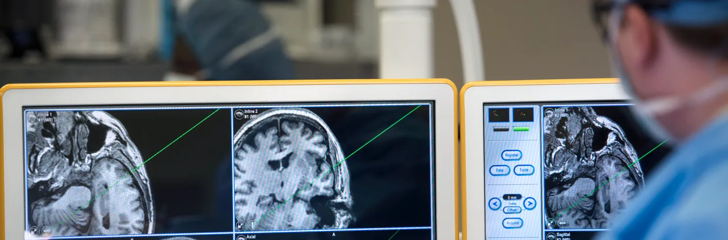 photo of brain images on three monitors, physician looking at them