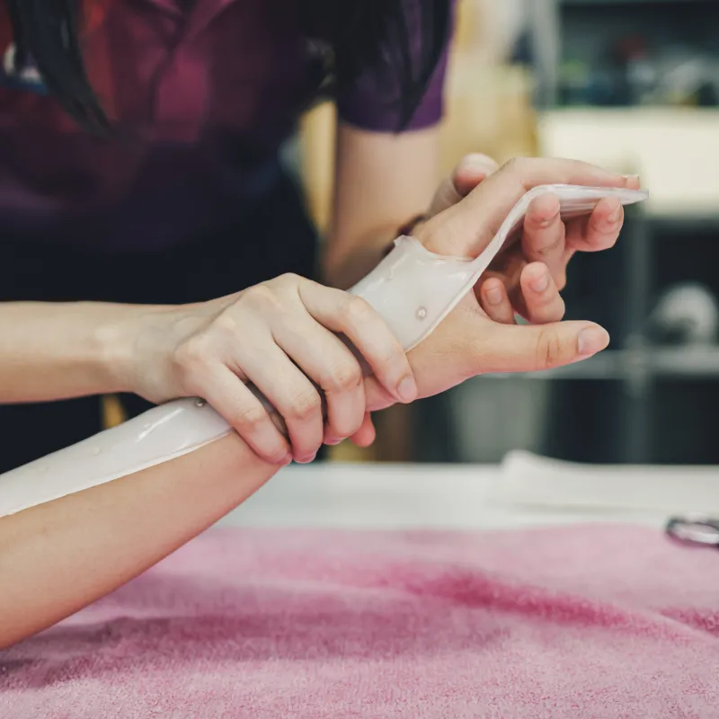 A health care provider is fitting a splint to a patients hand and arm. 