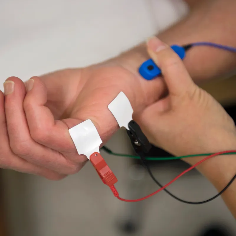 Patient hand with tremor sensors placed. 