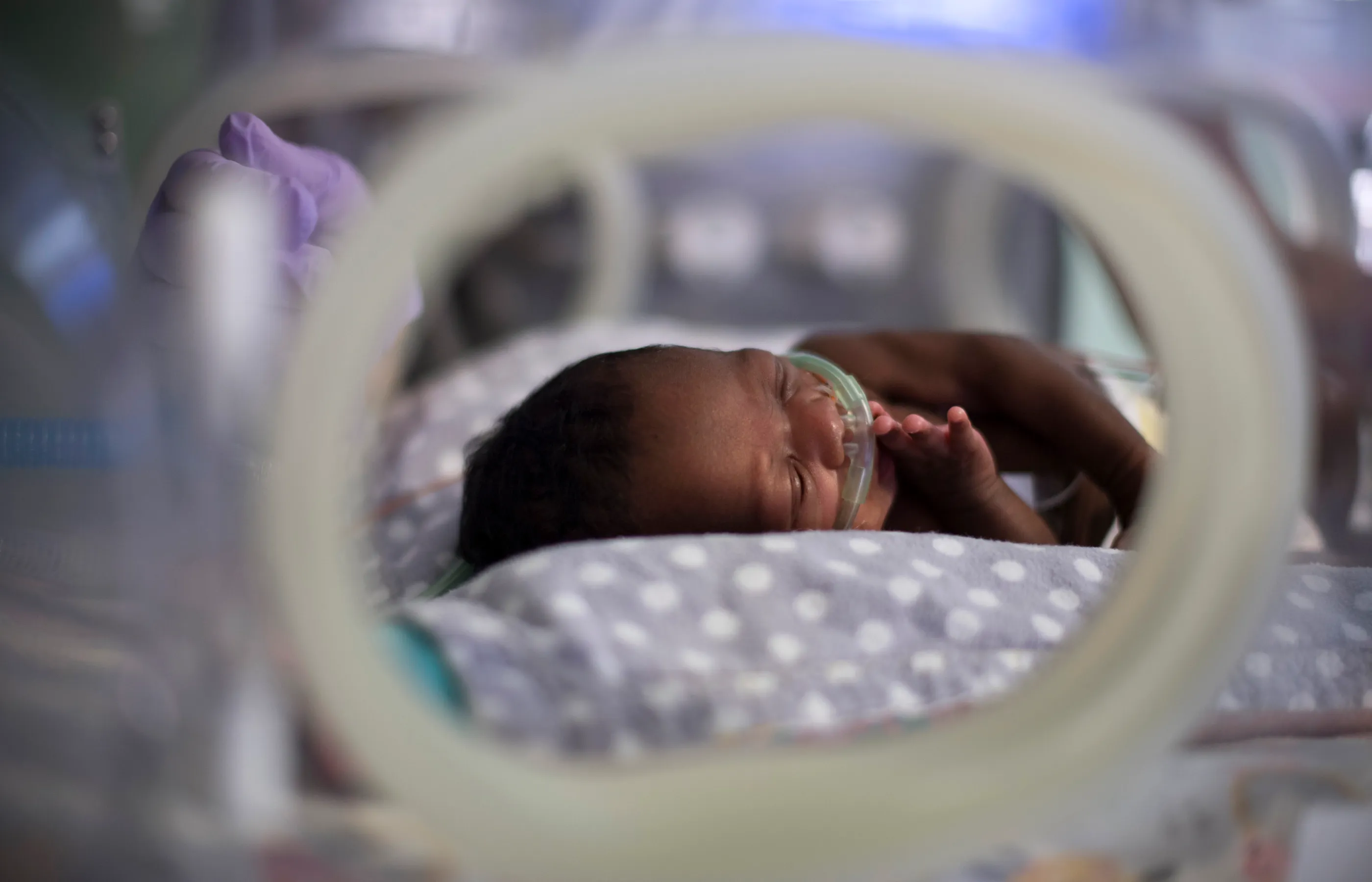 A premature baby is pictured lying in a giraffe NICU bed with a breathing tube.