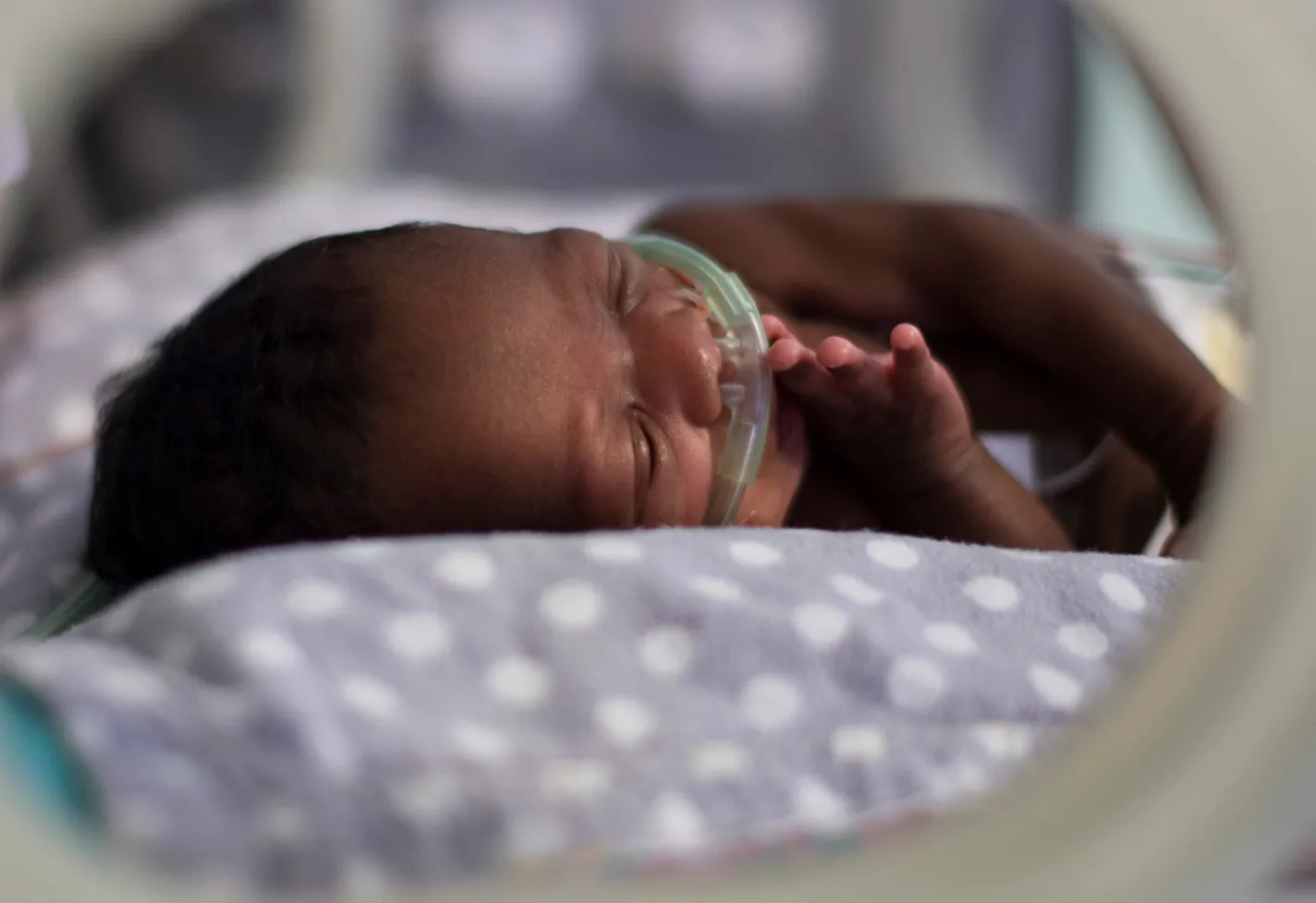A premature baby is pictured lying in a giraffe NICU bed with a breathing tube. A premature baby is pictured lying in a giraffe NICU bed with a breathing tube.