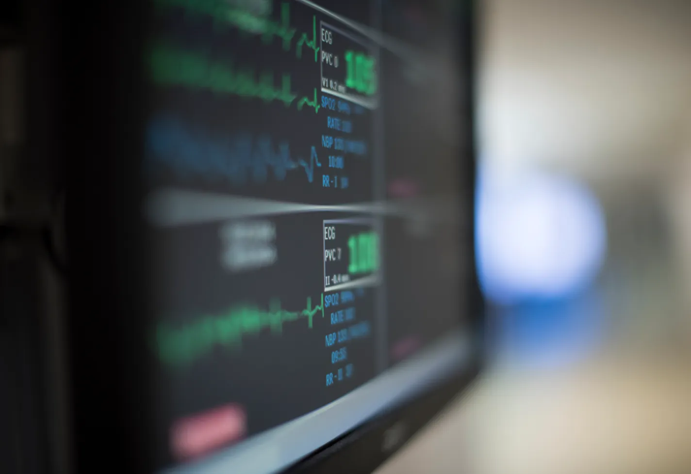 A close up of a patients electrocardiogram (ECG) monitor. 