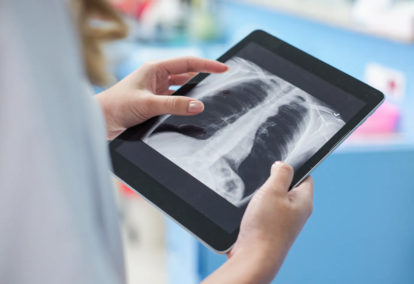 A health care provider is reviewing a patients chest x-ray on a tablet. A health care provider is reviewing a patients chest x-ray on a tablet.