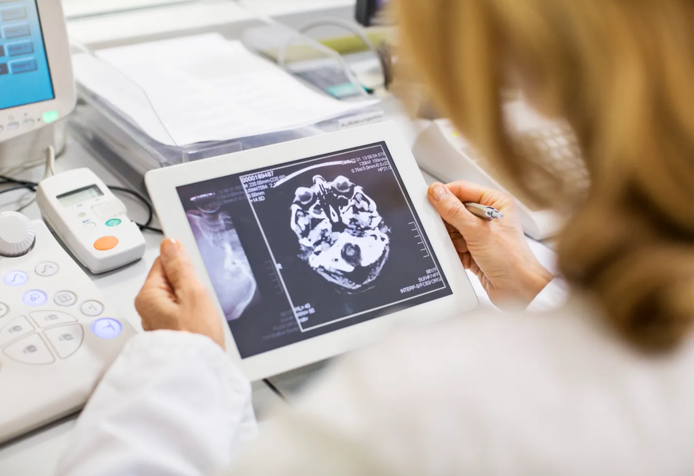A health care provider is reviewing a brain scan on a tablet. A health care provider is reviewing a brain scan on a tablet.