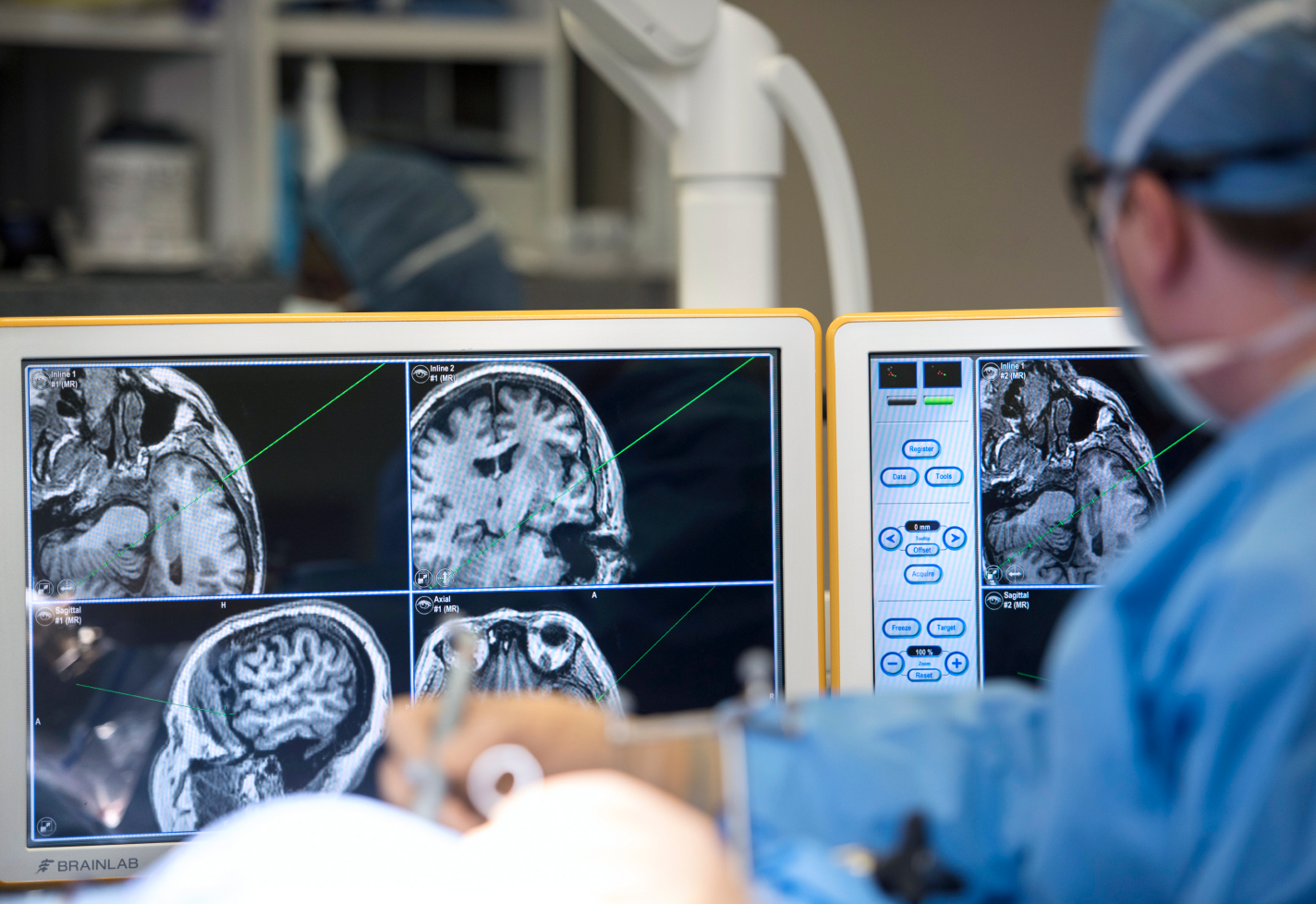 A brain surgeon looks at monitors while performing a procedure in the operating room. A brain surgeon looks at monitors while performing a procedure in the operating room.