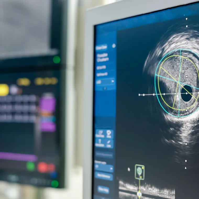 A closeup of a computer monitor, which displays, a patients imaging results. A closeup of a computer monitor, which displays, a patients imaging results.