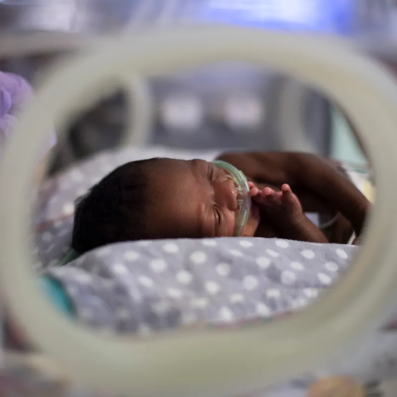 A premature baby is pictured lying in a giraffe NICU bed with a breathing tube.